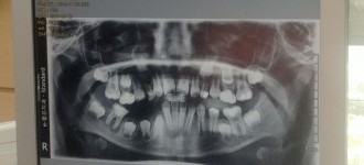 치과진료서비스 진행!(19차)